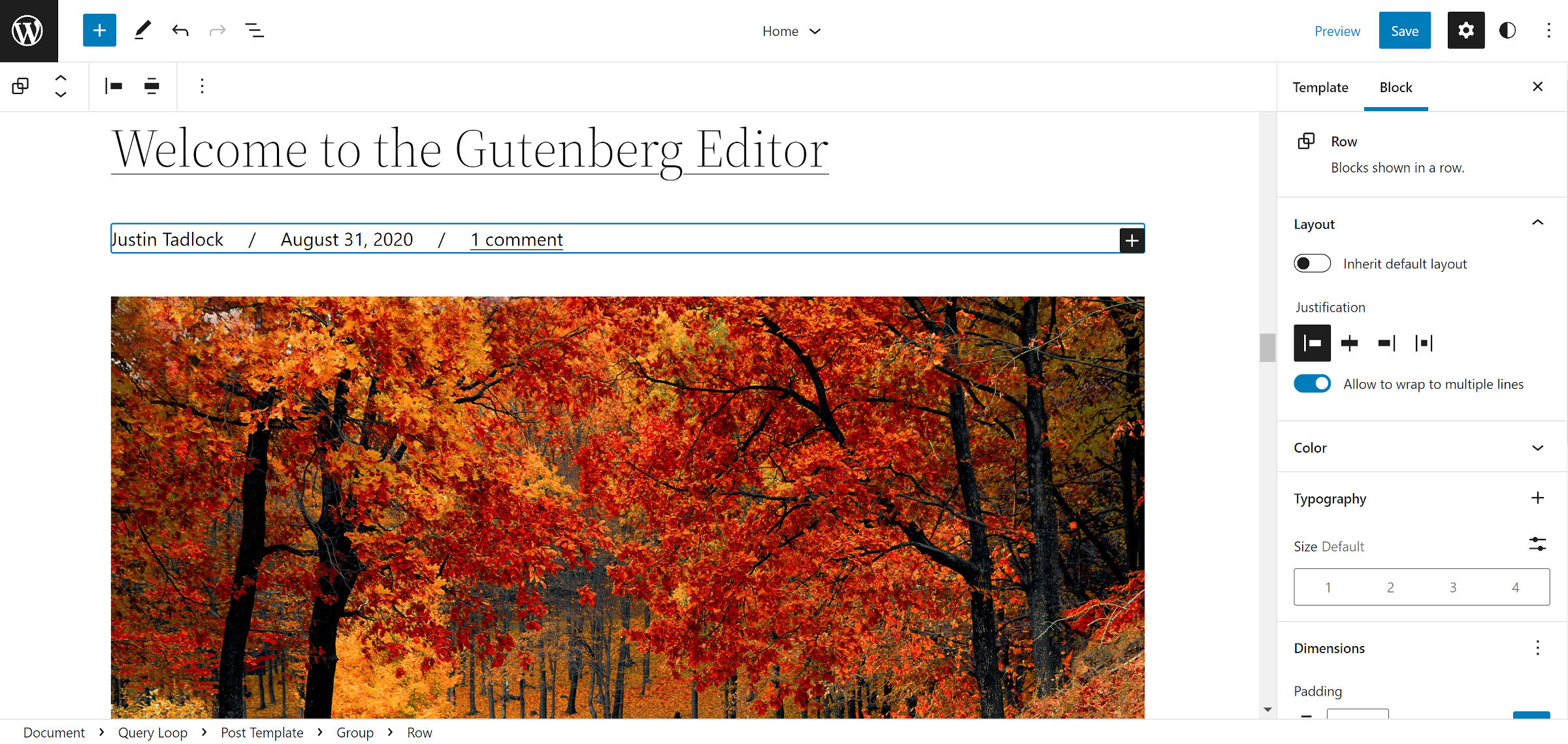 Inserimento di un'area di byline personalizzata nel blocco Query Loop nell'editor del sito di WordPress. Sotto il titolo del post, compare il nome dell'autore, la data e il link ai commenti.