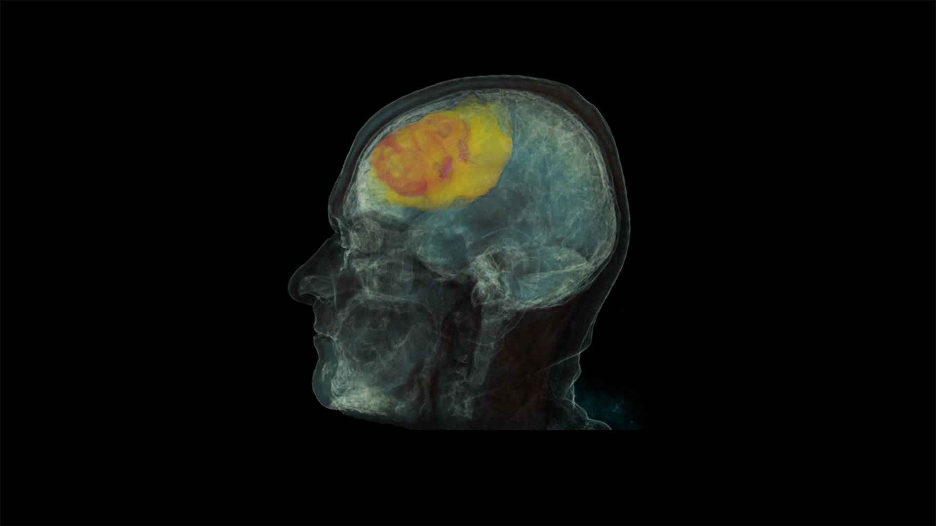 projeto imageeye varredura cerebral